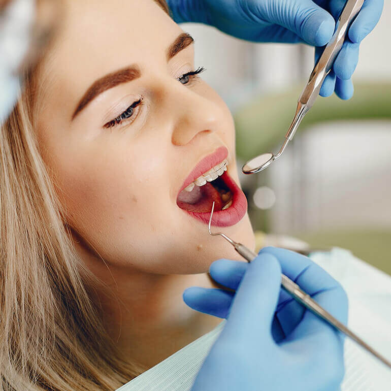 Ortodoncia y alineamiento de dientes en Puente Piedra